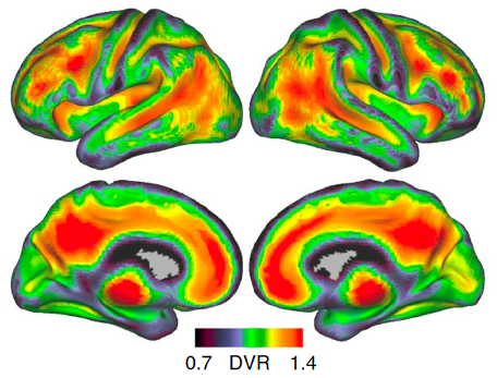 colored images of brain scans